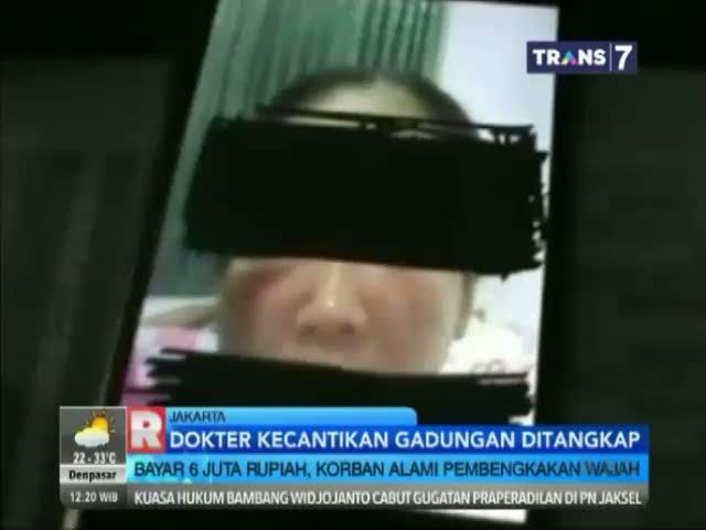 Dokter Kecantikan Gadungan Diringkus