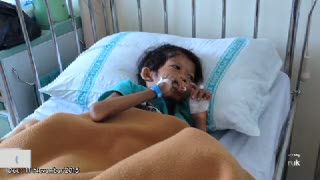 Pertanyakan Kondisi Reki, Ahok: Neneknya Gemuk Cucunya Gizi Buruk