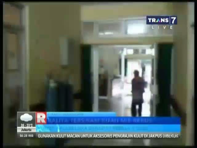 Balita Tersiram Kuah Mie Rebus 