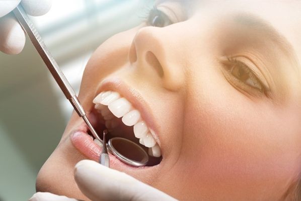 Gigi Bermasalah Jangan Ditunda! Ada Voucher Perawatan Gigi Murah di MHDC Clinic