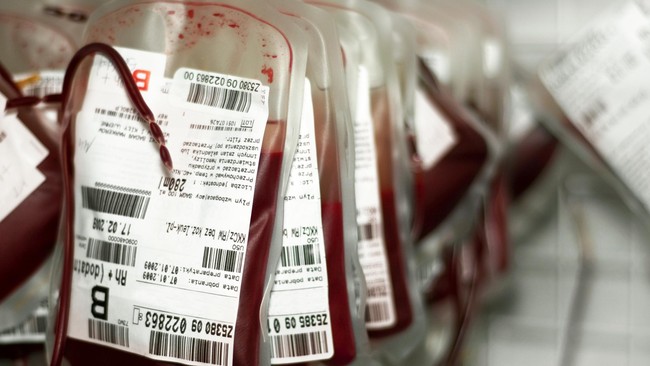 Anak-anak di Pakistan dinyatakan positif HIV setelah menerima transfusi darah. Mereka adalah penderita penyakit thalassemia yang secara rutin menerima transfusi