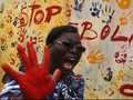 Penyintas Ebola Bisa Jadi Alami Kerusakan Otak