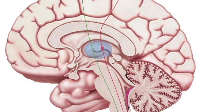 Perkembangan teknologi kedokteran memungkinkan para dokter masa kini untuk melakukan pembedahan dengan sayatan yang sangat kecil.
