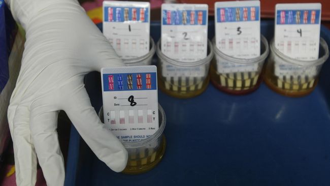 Salah satu tanda adanya gangguan ginjal bisa diamati dengan cara melihat urine. Urine yang keruh merupakan gejala adanya gangguan fungsi ginjal.