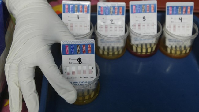 Polres Metro Jakarta Selatan mengungkap hasil tes urine MAS, remaja yang menusuk ayah dan neneknya hingga tewas di Cilandak, Jakarta Selatan, negatif narkoba.