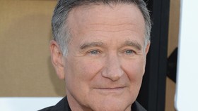 Demensia Lewi Body, Penyakit 'Pembunuh' Robin Williams