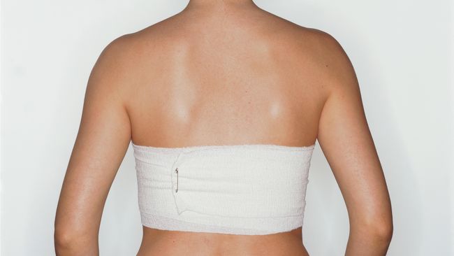 Terlalu Besar Wanita Inggris Susutkan Payudara