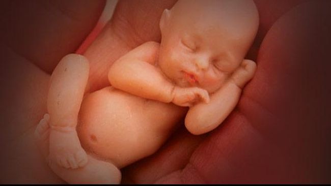 Penelitian kontroversial tersebut melibatkan pembedahaan organ vital, seperti ginjal dari bayi yang digugurkan