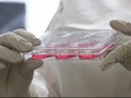 Antibodi Korban Selamat Ebola Gagal Cegah Kematian