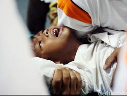 Anak Sering Garuk-garuk Mr P, Gejala Fimosis atau Minta Sunat?