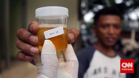Hasil Tes Urine, Eks Kapolsek Sepatan Berstatus Pengguna Aktif Sabu