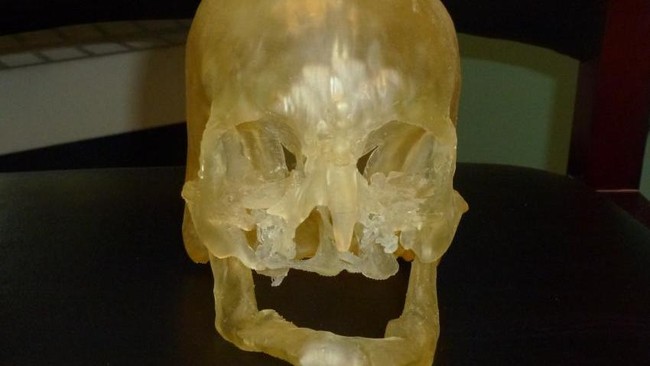 Para ilmuwan memadukan computed tomopgraphy dengan printer 3D untuk operasi transplantasi wajah. Keberhasilannya tergantung pada perencanaan bedah.