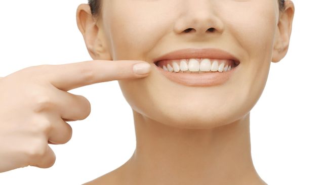 Veneer dan bleaching gigi memang sedang menjadi tren saat ini. Estetika gigi itu kini sedang digandrungi kaum hawa. Terlebih lagi kalangan selebriti. 