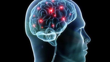 Pendarahan otak tanda dalam Pendarahan Otak