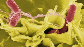 8 Gejala Infeksi Salmonella yang Paling Umum Dialami