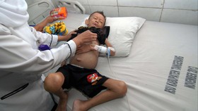 Gizi Buruk Ancam Semua Lapisan Masyarakat