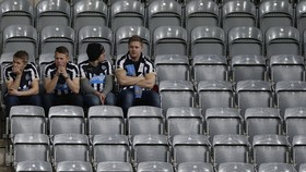 Pakai Kostum Newcastle, Pria Inggris Dibunuh Zebra