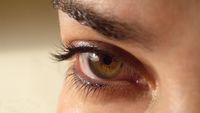 Penyebab dan Cara Menghentikan Mata Berair