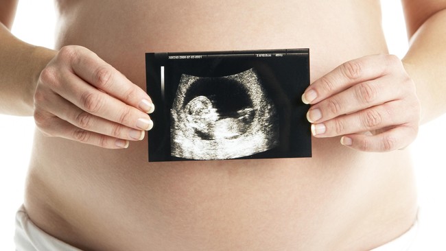 Thailand mengeluarkan UU baru yang melarang warga asing menggunakan jasa surrogacy, atau ibu pengganti.