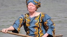 Tanzania Tangkap 32 Dukun Pembunuh Warga Albino