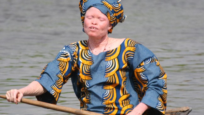 Dalam kepercayaan masyarakat primitif Tanzania anggota tubuh albino bisa digunakan untuk kesuksesan di bidang bisnis, kehidupan dan percintaan.