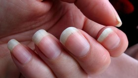 Tampil Cantik dengan Baking Soda