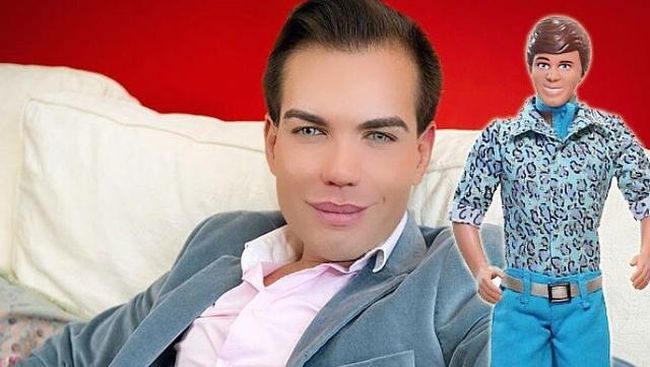 Pria Boneka Yang Habiskan Rp 3 M Demi Mirip Pacar Barbie