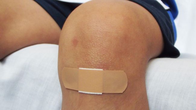 Resistensi antibiotik bisa membuat seseorang mengalami infeksi, termasuk pada luka yang dimiliki. Berikut ciri-ciri infeksi luka akibat resistensi antibiotik.