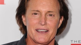Ayah Tiri Kim Kardashian, Bruce Jenner, Alami Kecelakaan
