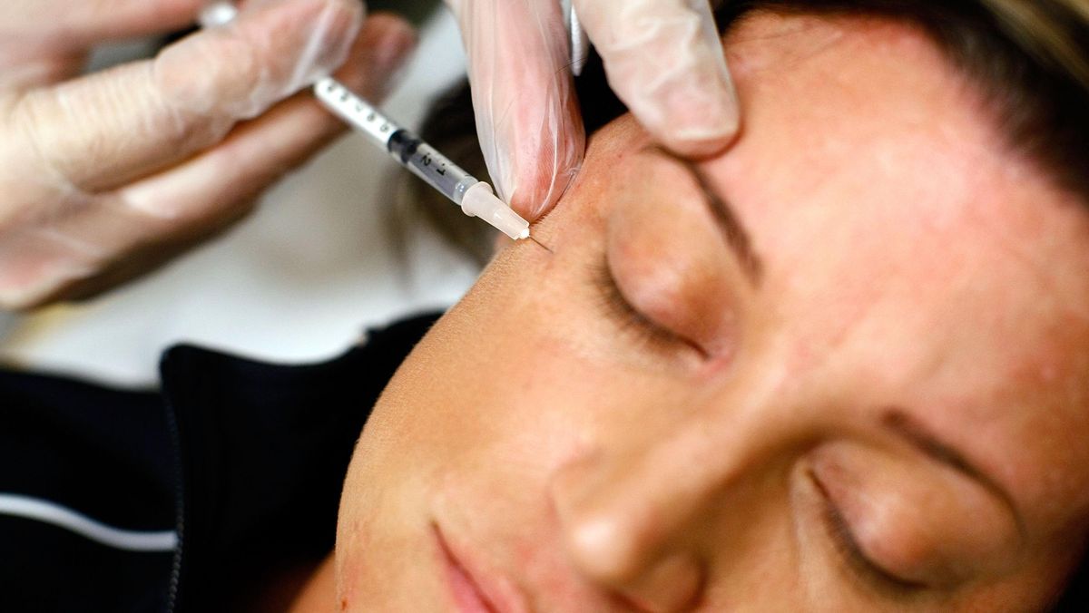 Kapan Perlu Suntik Botox? Ahli Dermatologi Berikan Panduannya