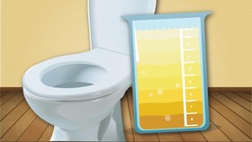 Ketahui Warna Urine dan Artinya untuk Ungkap Kondisi Tubuh