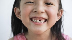 10 Kebiasaan yang Bisa Merusak Gigimu