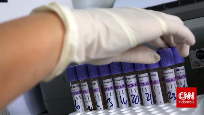 Kemenkes menyatakan Puskesmas kini memberi pelayanan rapid test dan tes swab PCR untuk mendeteksi penularan virus corona (Covid-19).