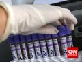 Kemenkes Sebut Puskesmas Bisa Layani Tes Swab Corona