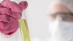 Kampus Inggris Kembangkan Urine untuk Pembangkit Listrik