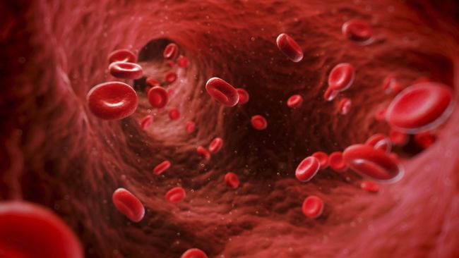Pengidap kanker CML, kemungkinan bisa sembuh melalui transplantasi sumsum tulang belakang.