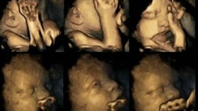 Ibu, Ini yang Dilakukan Bayi di Dalam Rahim
