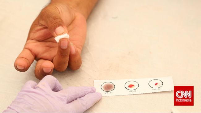 Awal pemeriksaan, seringkali pengidap kanker CML disangka terserang TBC atua infeksi biasa karena tingginya produksi sel darah putihnya.