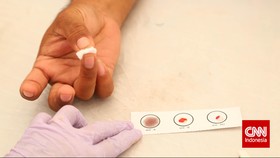 Kepribadian Dapat Dilihat dari Golongan Darah?