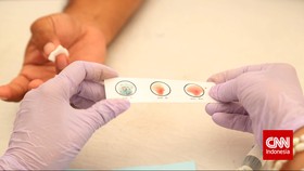 Pemerintah Kaji 'Rapid Test' Virus Corona Pakai Serum Darah