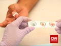 Studi: Orang Tipe Darah A Lebih Berisiko Alami Gejala Serius