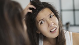 Cara Mengatasi Rambut Megar seperti 'Singa'