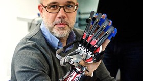 Sarung Tangan Robot Mutakhir untuk Penyintas Stroke