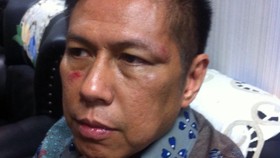 Mulyadi Klaim Serangan Mustofa Murni Penganiayaan