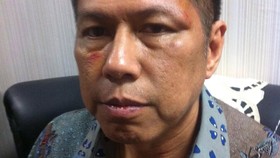 Majelis Kehormatan DPR Usut Insiden Adu Jotos