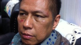 Pimpinan DPR Tunggu Proses Hukum Pemukulan di Komisi VII