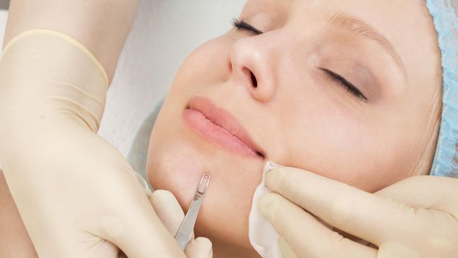 Masker andtikomedo dari daun jambu biji itu diyakini lebih aman terhadap kulit wajah dibandingkan produk atau cara lain dalam mengangkat komedo.