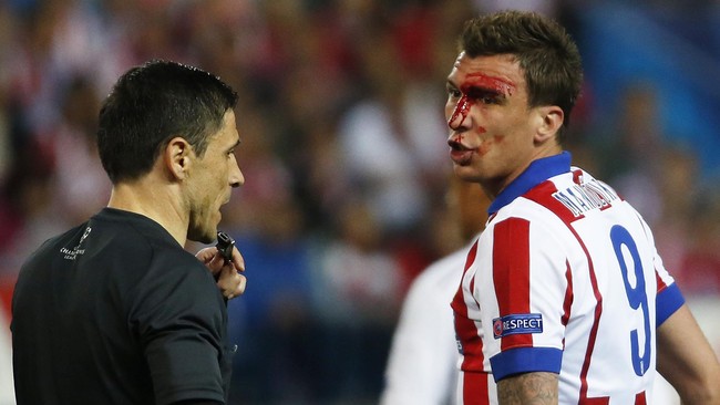 Tak ada hukuman dari wasit ketika pemain belakang Real Madrid, Dani Carvajal, menggigit sang penyerang lawan, Mario Mandzukic.
