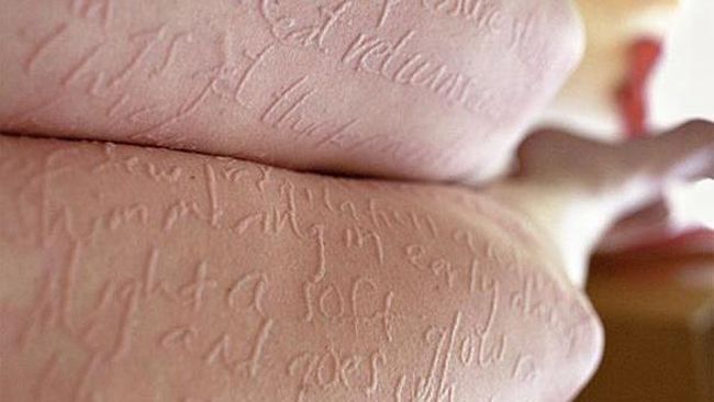 Dampak penyakit langka lebih berat dibandingkan kanker dan AIDS. Namun, penyakit ini bisa diprevensi atau ditangani kesembuhannya.