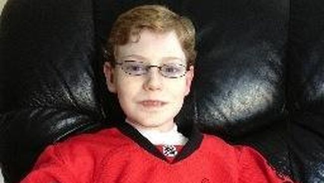 Jonathan Pitre dipanggil sebagai anak kupu-kupu, karena kulitnya serapuh sayap kupu-kupu.
